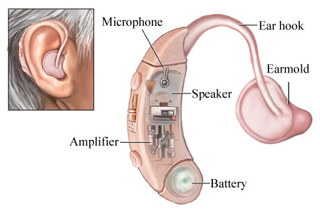 digital hearing aids diagram